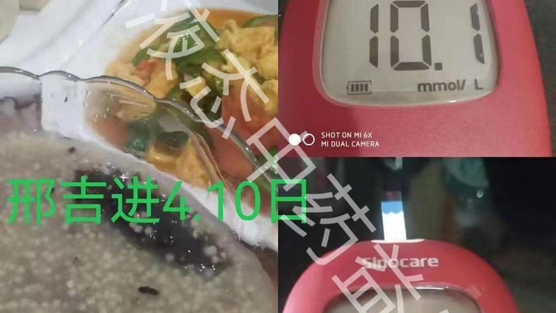 氨糖300粒大瓶装：揭秘关节健康守护者的性价比之选